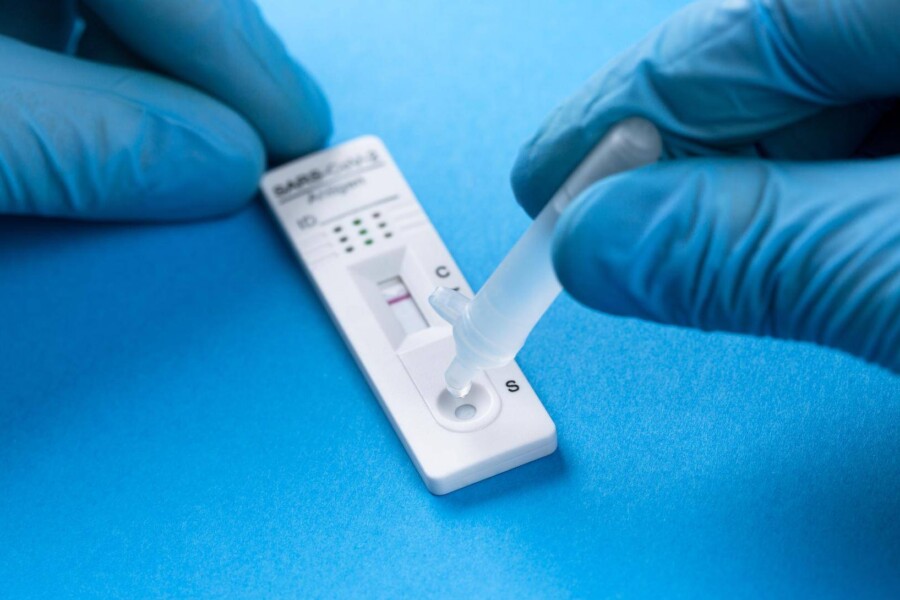 Jaki test lepszy PCR czy antygenowy w codziennej diagnostyce?
