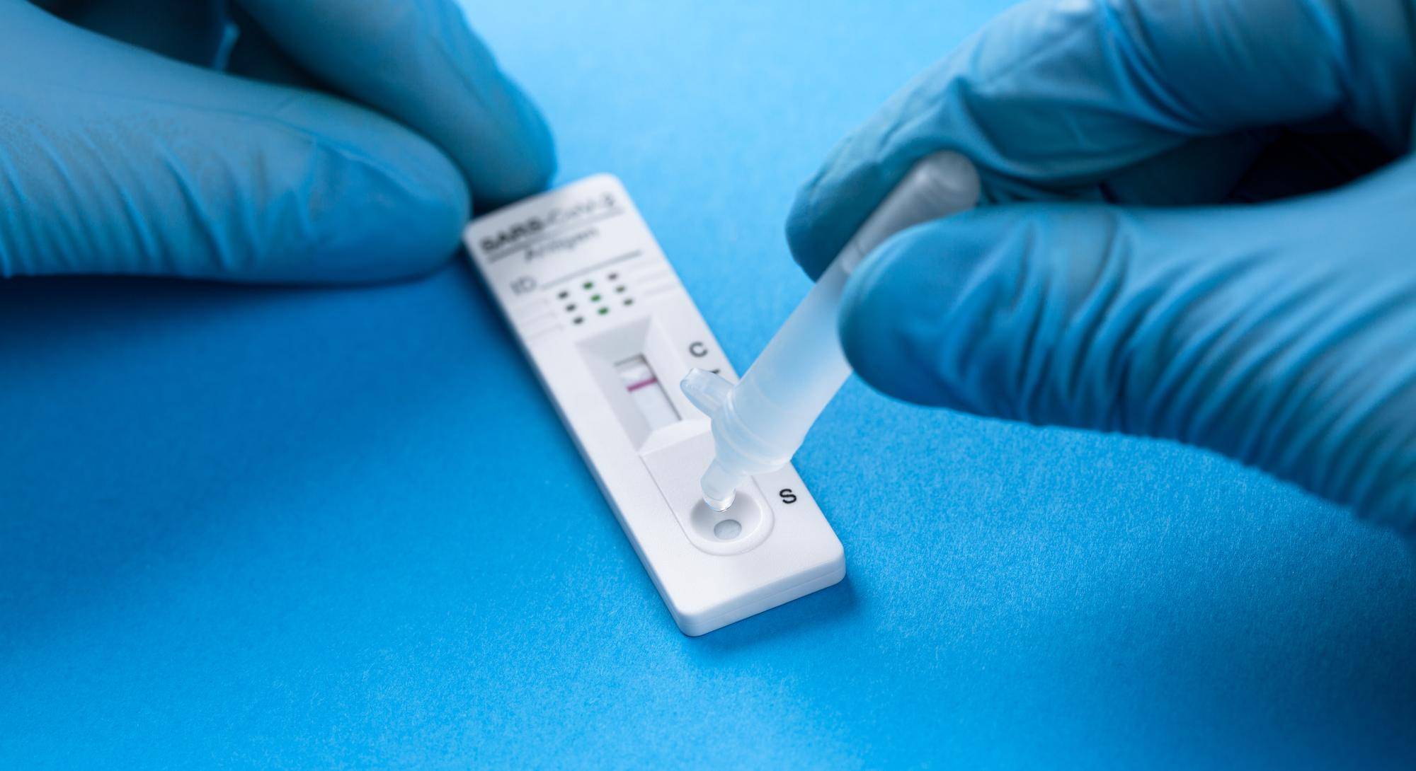 Jaki test lepszy PCR czy antygenowy w codziennej diagnostyce?